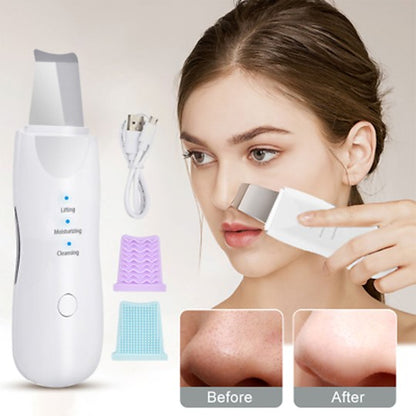 Electric Blackheads Remover